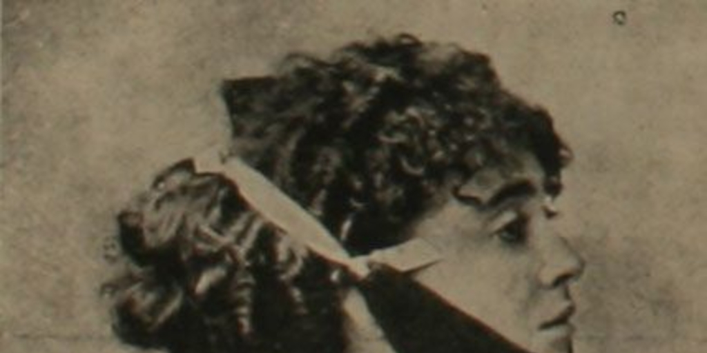 Ortopedia casera para quitar la doble barba, 1911