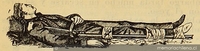 Aparato de fractura improvisado con fusil, ca. 1897