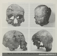 Vistas del cráneo de esqueleto 99.1/779 excavado en Cerro Sota.Viajes y arqueología en Chile austral. Ediciones de la Universidad de Magallanes, Punta Arenas. 1988.