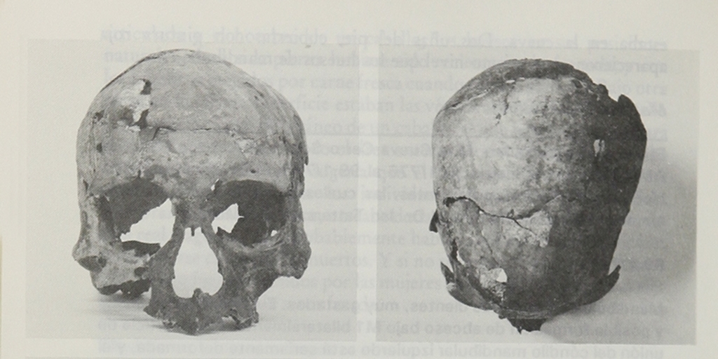 Vistas del cráneo de esqueleto 99.1/779 excavado en Cerro Sota.Viajes y arqueología en Chile austral. Ediciones de la Universidad de Magallanes, Punta Arenas. 1988.